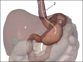 Stomach tube insertion