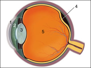 Eye flashers and floaters