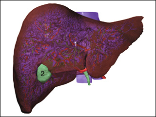 Site of liver scan