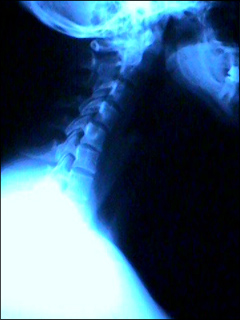 Neck X-ray